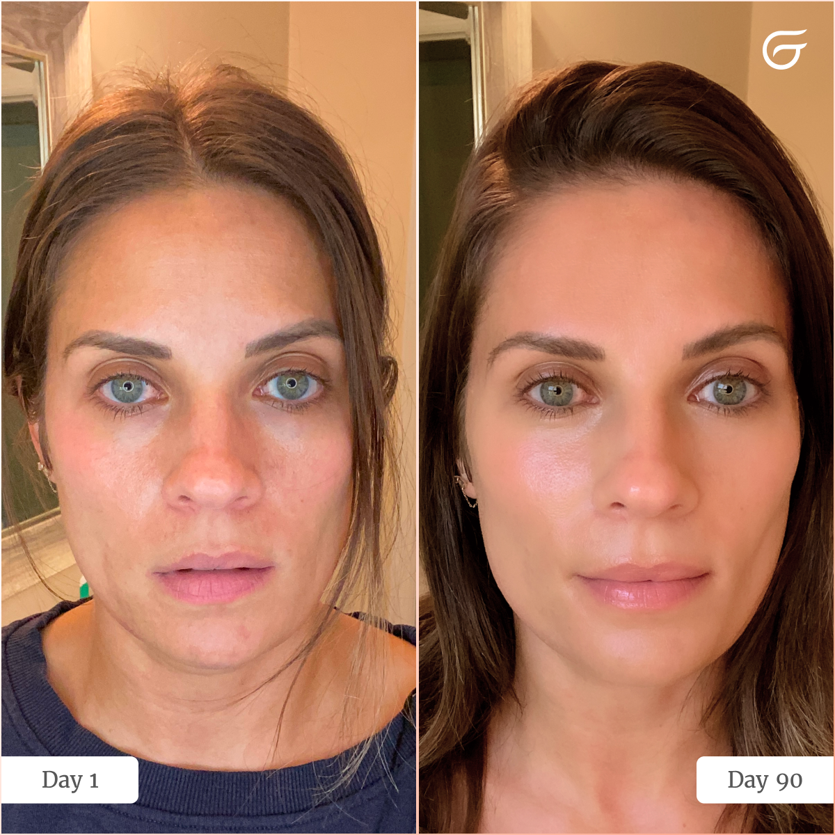 Groomie Hers - GlowUp™ LED Light Therapy Face Mask