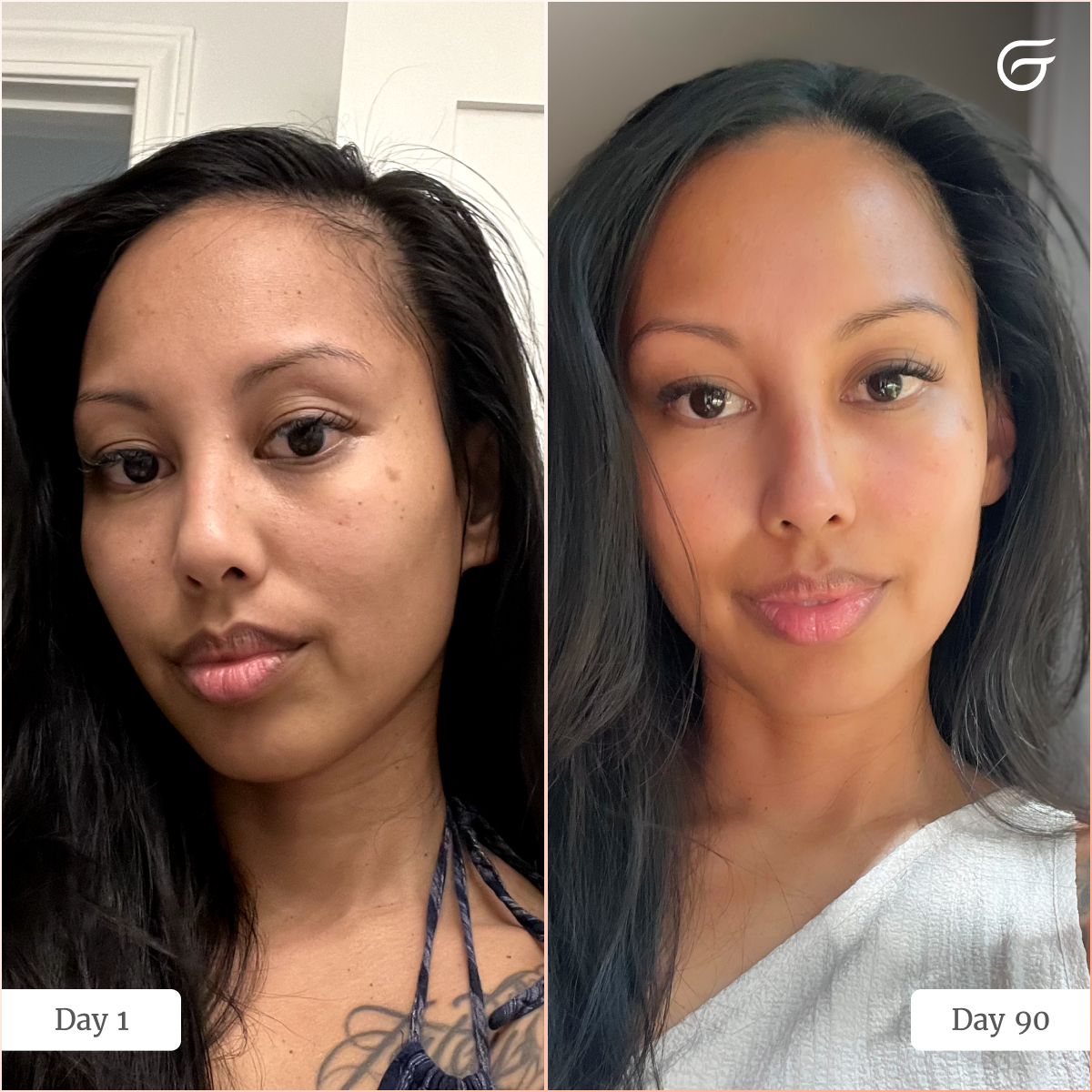 Groomie Hers - GlowUp™ LED Light Therapy Face Mask